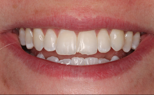 Dental Services Patient Results After