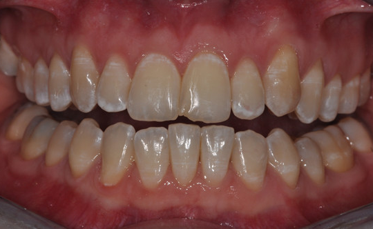 Dental Services Patient Results Before