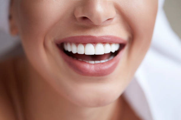 A woman shows off her bright smile after a teeth whitening treatment.